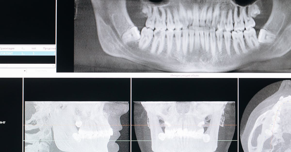 Le guide complet du piercing oral : tout ce que vous devez savoir