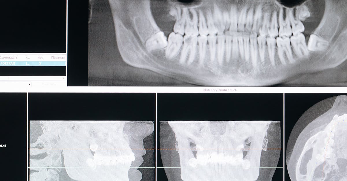 découvrez tout ce qu'il faut savoir sur le piercing oral : types, techniques, soins et conseils pour un bijou esthétique et sécurisé. explorez les tendances, les risques éventuels et les questions fréquentes pour un piercing réussi.