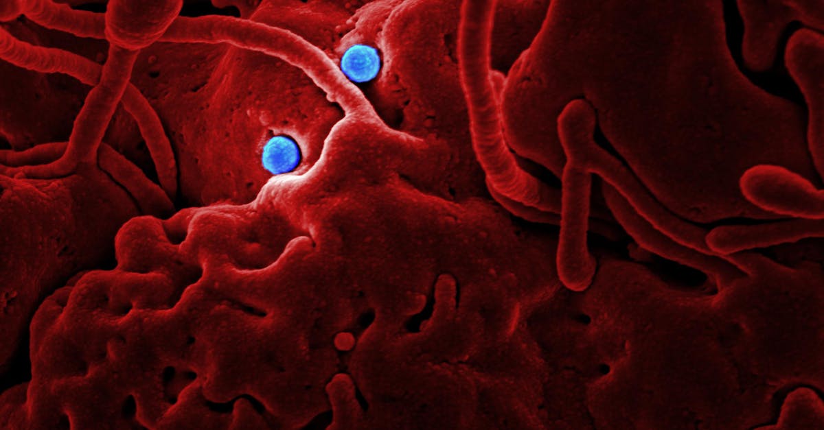 découvrez tout ce qu'il faut savoir sur les infections : symptômes, causes, traitements et prévention. informez-vous pour mieux protéger votre santé et celle de vos proches.