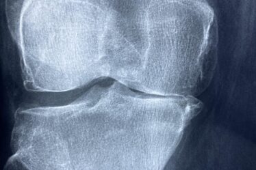 d&eacute;couvrez tout sur le cartilage de l'oreille : structure, fonctions, blessures courantes et soins pour maintenir la sant&eacute; de votre oreille.